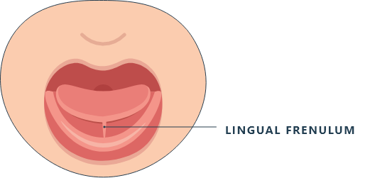 Open mouth diagram showing lingual frenulum location.